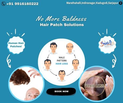 Seamless Coverage: Human Hair Patch Solutions | hair fixing in bangalore | Scoop.it