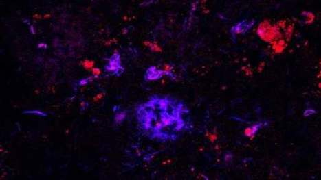 Anti-Alzheimer's antibodies clean out brain plaques in mice | Longevity science | Scoop.it