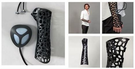 Osteid : Un mod&egrave;le de pl&acirc;tre intelligent et connect&eacute; | e-Sant&eacute;, Objets Connect&eacute;, Senior 3.0, Silver Economie, D&eacute;pendance N.0! | Scoop.it