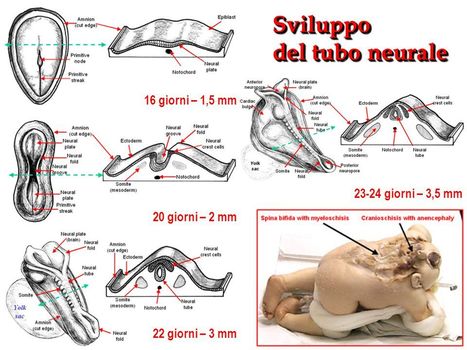 Struttura e funzione nel sistema nervoso centrale: il concetto di area corticale.           Prof. Stefano Rozzi | One Health News: salute, ambiente, animali e società - A cura di ISDE, Festival della salute, Marketing sociale. N°18 | Scoop.it