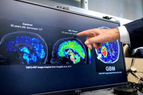 Alzheimer&nbsp;: &laquo; Le plus grand danger n&rsquo;est plus seulement la maladie, mais aussi le retard du diagnostic &raquo; | D&eacute;pendance et fin de vie | Scoop.it