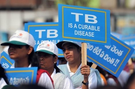 La tuberculose recule pour la première fois dans le monde | Chronique des Droits de l'Homme | Scoop.it