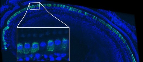 Local gene therapy durably restores vestibular function in a mouse model of Usher syndrome type 1G | Vectorology - GEG Tech top picks | Scoop.it