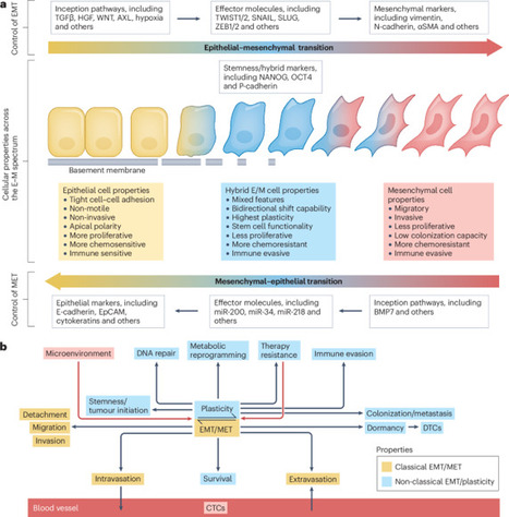 EMT and cancer: what clinicians should know | Nature Reviews Clinical Oncology | from Flow Cytometry to Cytomics | Scoop.it