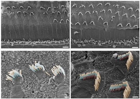 Une th&eacute;rapie g&eacute;nique novatrice a permis &agrave; des souris n&eacute;es sourdes d'entendre | Revue de presse Implant Cochl&eacute;aire | Scoop.it