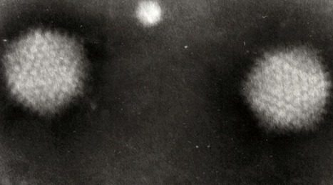 Four New Strains of Human Adenovirus Found in Singapore | Virus World | Scoop.it