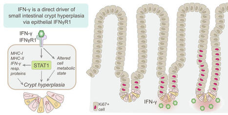 JCI - Interferon-γ is a direct driver of crypt hyperplasia in celiac disease | Mucosal Immunity | Scoop.it