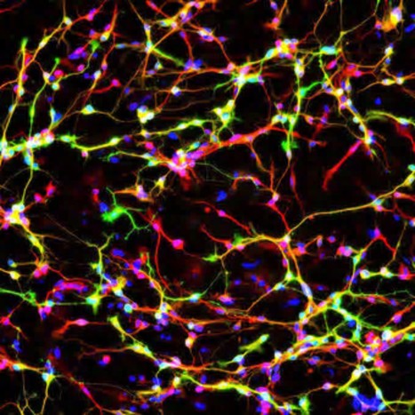 Kurzweil : "Parkinson’s disease researchers discover a way to reprogram the genome... | Ce monde à inventer ! | Scoop.it