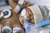 Observan una tendencia de futilidad médica en las muertes neonatales: MedlinePlus | Salud Publica | Scoop.it