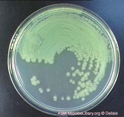 Small Things Considered: Are Phages the Answer? | Virology News | Scoop.it