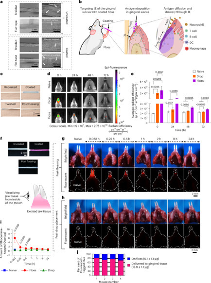 Floss-based vaccination targets the gingival sulcus for mucosal and… | Stéphane Paul | Mucosal Immunity | Scoop.it
