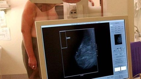 Woman refused mammogram, told she was 'too young', then diagnosed with breast cancer | Hospitals and Healthcare | Scoop.it