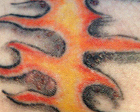 Risque tatouage : Risques infections, réactions allergiques et cancer de la peau | Toxique, soyons vigilant ! | Scoop.it