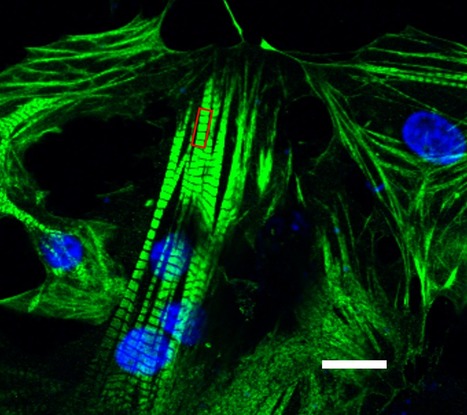 Structural Maturation of Human Cardiomyocytes Derived from Pluripotent Stem Cells | iBB | Scoop.it