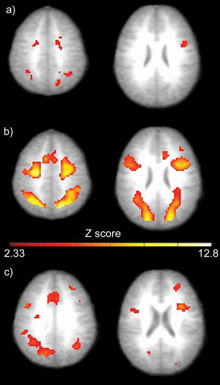 Brain Imagery Supports the Idea of Diverse Intelligences | Intelligences Multiples | Scoop.it