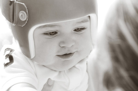 Positional Plagiocephaly | Common Medical Questions | Medical and Health | Scoop.it