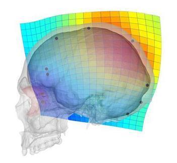 La evolución del cráneo humano ha propiciado problemas visuales y neurológicos | Salud Visual 2.0 | Scoop.it
