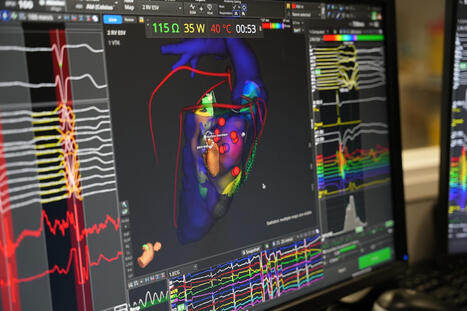 Le CHU de Toulouse adopte le "Google maps du coeur"&nbsp; &bull; | GRIEPS | Scoop.it