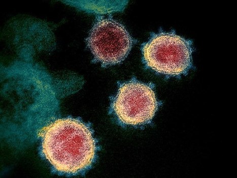 CNET France : "Comment l'Intelligence Artificielle peut aider à lutter contre le coronavirus | Ce monde à inventer ! | Scoop.it