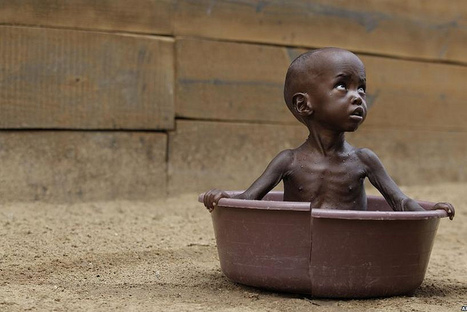 Plus de 38.000 enfants risquent de mourir de faim en Somalie | Koter Info - La Gazette de LLN-WSL-UCL | Scoop.it
