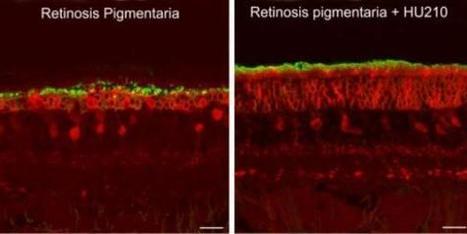 El principal componente de la marihuana conserva la vista de las ratas con retinosis | Salud Visual 2.0 | Scoop.it