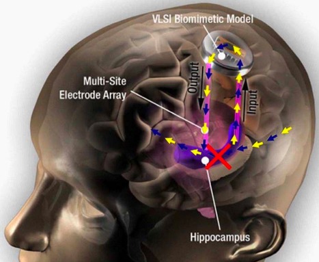 DARPA-funded prosthetic memory system successful in humans, study finds | KurzweilAI | Longevity science | Scoop.it