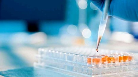 Quelques précisions sur « l’espoir fou » du vaccin contre le sida mis au point à Marseille | sida | Scoop.it