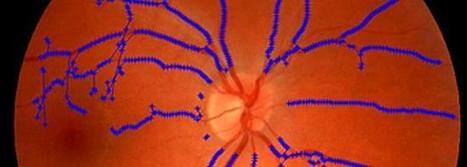 Un software para detectar enfermedades analizando la retina | Salud Visual 2.0 | Scoop.it