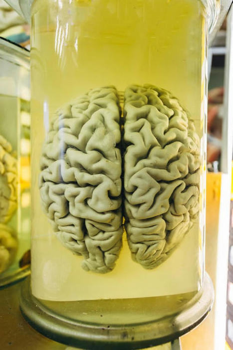 Virtual Brain Banks Are Evolving Into Rich, Accessible Digital Brain Libraries | by Dr. Patricia Farrell | BeingWell | May, 2021 | Digital Collaboration and the 21st C. | Scoop.it