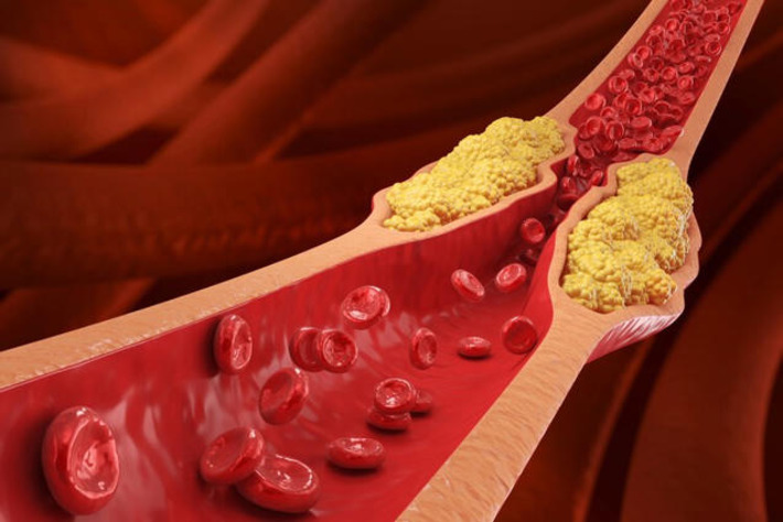 The countries with the lowest (and highest) cholesterol levels in the world | The Health Report | Scoop.it