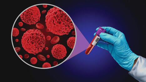 Liquid and Synthetic Biopsies Are Poised to Rewrite Cancer Care - IEEE Pulse | Brian Sorg, PhD, MBA | from Flow Cytometry to Cytomics | Scoop.it