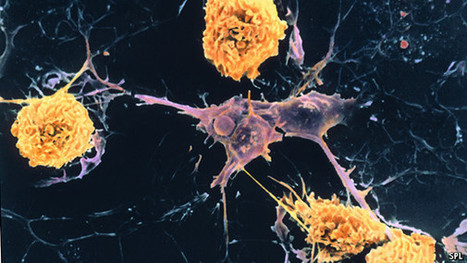 A curious observation may lead to a treatment for multiple sclerosis | Scl&eacute;rose en Plaques | Scoop.it