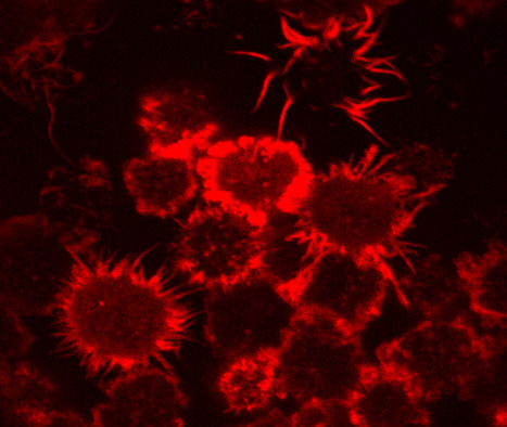 Using Dendritic Cells to Evaluate How Burkholderia cenocepacia Subvert Immune Functions | iBB | Scoop.it