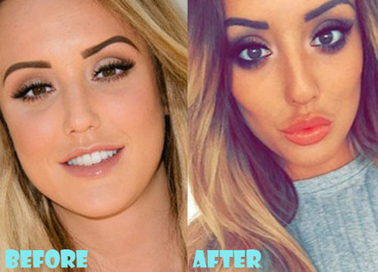 Charlotte Crosby Plastic Surgery Before And Aft