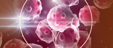 La #greffe de cœur augmenterait le risque de #cancer #Patient #MoiPatient #hcsmeufr  | autour du CANCER | Scoop.it