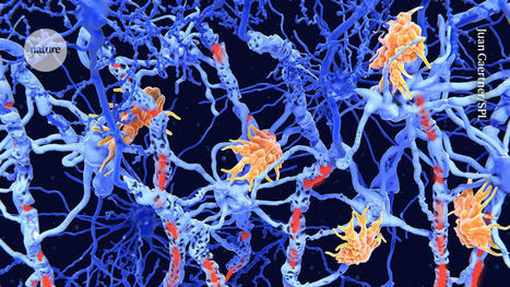 CAR-T therapy for multiple sclerosis enters US trials for first time | NeuroImmunology | Scoop.it