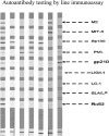 A comprehensive analysis of antigen-specific autoimmune liver disease related autoantibodies in patients with multiple sclerosis | Autoimmunity Highlights | Full Text | AUTOIMMUNITY | Scoop.it