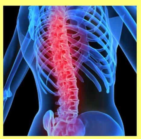 When Do You Need Surgery for Multilevel Spondylosis? | Medical and Health | Scoop.it