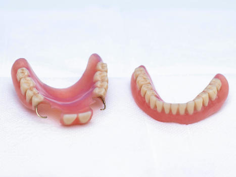 Denture Reline Vs Rebase: What You Need To Know | Smilepoint Dental Group | Scoop.it