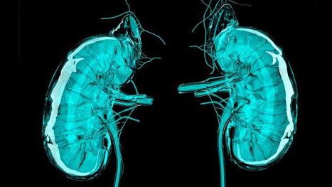 Surgeon Anthony Atala demonstrates an early-stage experiment of 3D printing a human kidney | Amazing Science | Scoop.it