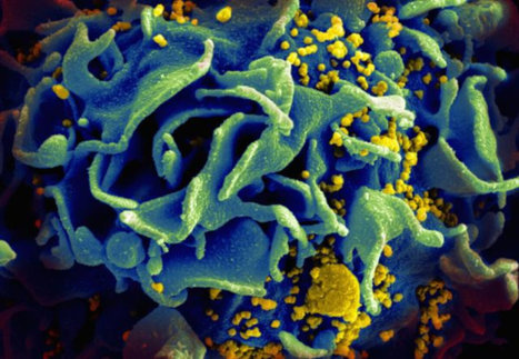 Study Confirms Correlates of Risk Associated with Decrease in HIV Transmission | Virus World | Scoop.it