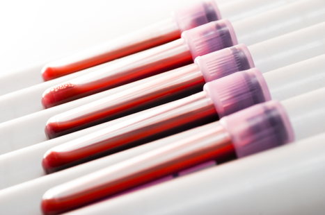 Illumina plans bacterial genomics clinical microbiology service | In-Vitro Diagnostic | Scoop.it