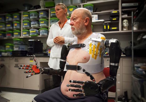 Cet homme amputé des deux bras revit grâce à deux prothèses robotisées | Buzz e-sante | Scoop.it