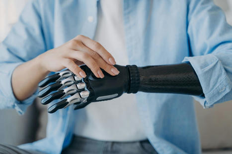 Cure Bionics is developing 3D-printed prosthetic limbs | consumer psychology | Scoop.it
