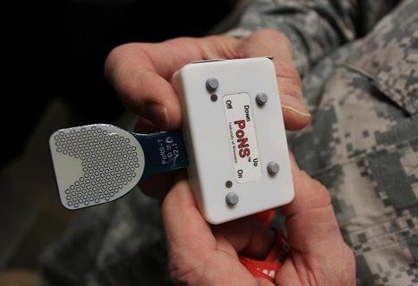 New Device Treats Brain Injury By Zapping Nerves On The Tongue | Innovating in an Age of Personalization | Scoop.it