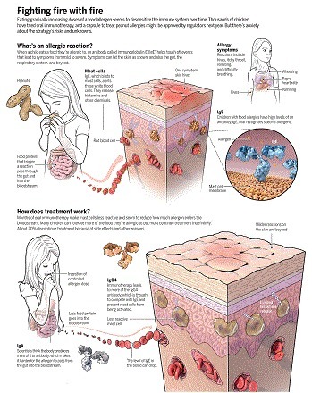 Toxin or treatment? Peanut allergy | Allergy (and clinical immunology) | Scoop.it