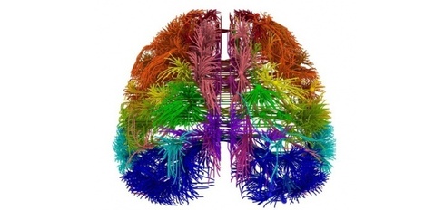 Maladies du cerveau : 1 personne sur 3 sera un jour concernée | Think outside the Box | Scoop.it