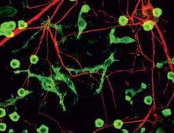 Immune cells gobble up healthy but idle brain cells | Science News | Scoop.it