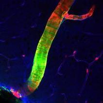 Scientists Discover Previously Unknown Cleansing System in Brain | Amazing Science | Scoop.it