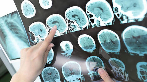 Brain Waves at 9 May Predict Teen Mental Health Risk | Grief & Bereavement Counseling | Scoop.it